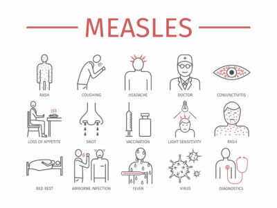 Measles. Symptoms, Treatment. signs for web graphics